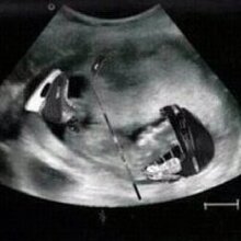 Инна, г. Москва