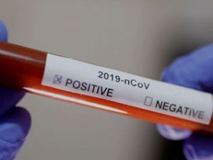 какое смс приходит при коронавирусе положительном