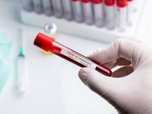 упали лейкоциты в крови при коронавирусе что делать. Смотреть фото упали лейкоциты в крови при коронавирусе что делать. Смотреть картинку упали лейкоциты в крови при коронавирусе что делать. Картинка про упали лейкоциты в крови при коронавирусе что делать. Фото упали лейкоциты в крови при коронавирусе что делать