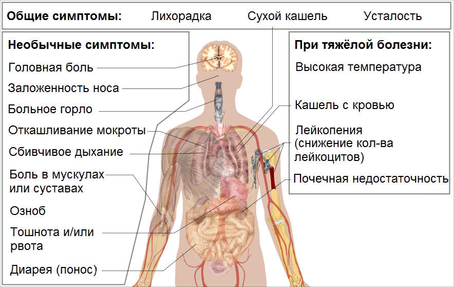 боль в ухе при коронавирусе чем лечить. Смотреть фото боль в ухе при коронавирусе чем лечить. Смотреть картинку боль в ухе при коронавирусе чем лечить. Картинка про боль в ухе при коронавирусе чем лечить. Фото боль в ухе при коронавирусе чем лечить