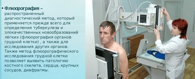 для чего делают флюорографию со спины. Смотреть фото для чего делают флюорографию со спины. Смотреть картинку для чего делают флюорографию со спины. Картинка про для чего делают флюорографию со спины. Фото для чего делают флюорографию со спины