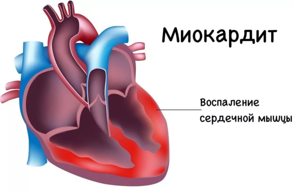 короновирусный хвост что такое. Смотреть фото короновирусный хвост что такое. Смотреть картинку короновирусный хвост что такое. Картинка про короновирусный хвост что такое. Фото короновирусный хвост что такое