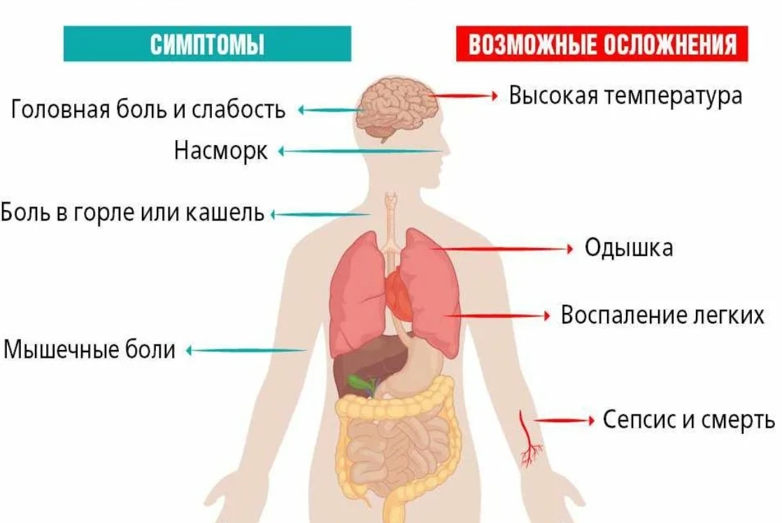 Симптомы коронавирусной инфекции картинки