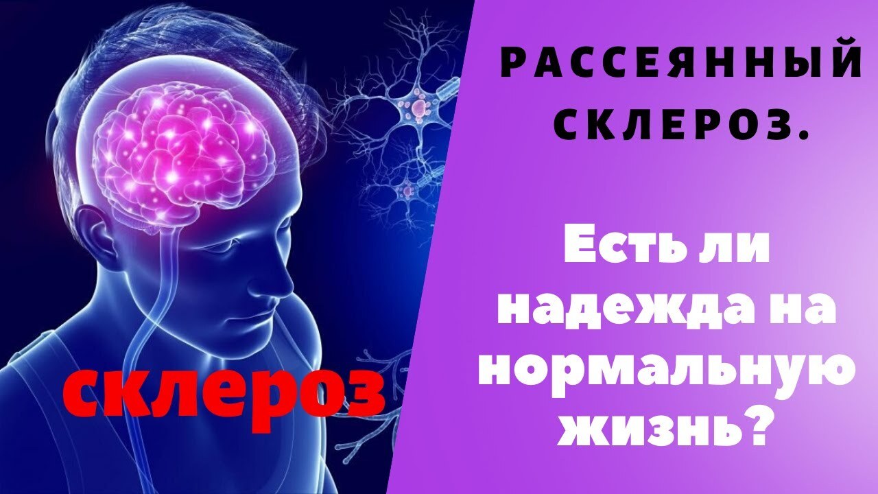 Всемирный день борьбы с рассеянным склерозом. | Вася, 26 мая 2021