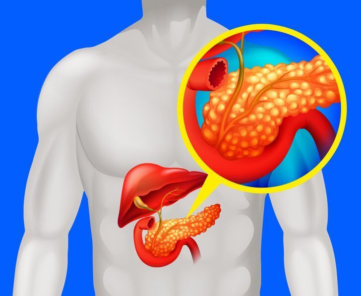 Самый дорогой орган человека. Панкреатическая диарея. Панкреатогенный понос. Поджелудочная железа понос.
