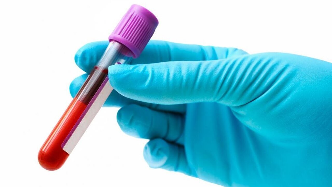 Коагулограмма, что за анализ такой. Важен при беременности.