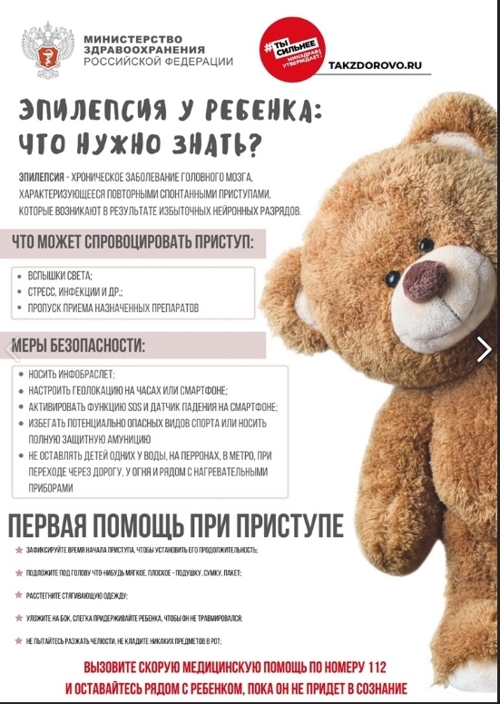 Эпилепсия. Что нужно знать!