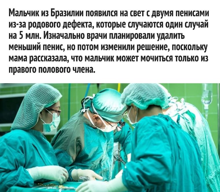 Редкая патология у мальчиков: один случай на 5 миллионов