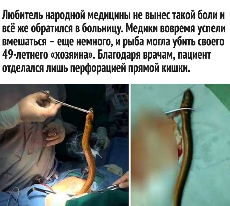 Народная медицина отдыхает или как китаец лечил запор с помощью угря