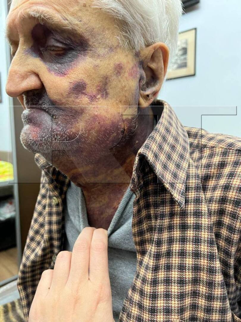 В Москве украинец избил 84-летнего подполковника за то, что он поддерживает спецоперацию.