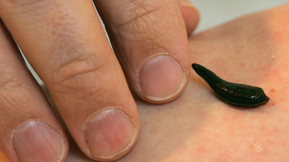 Альтернативные методы лечения: какие методы работают, а какие нет?