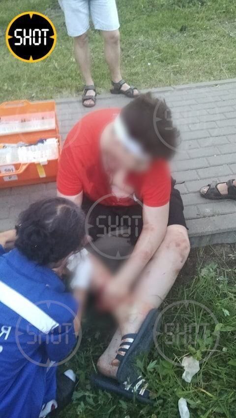 В Химках у 13-летного подростка во рту взорвалась электронная сигарета.