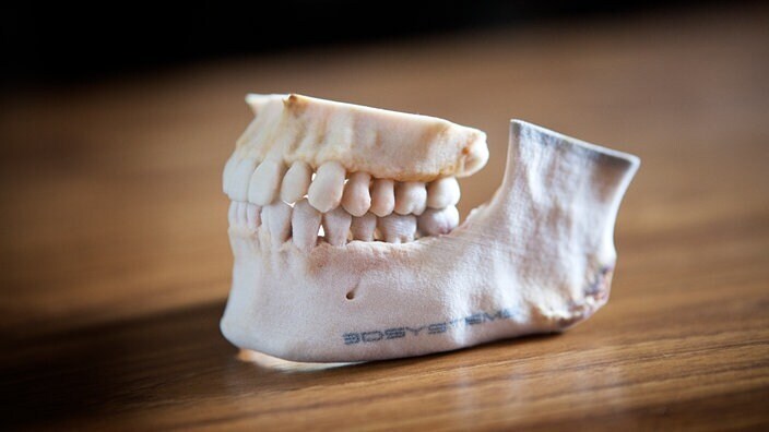 Зубной имплантат, протез стопы, кусок черепной коробки – в медицинской технике 3D-печать пользуется большим успехом.