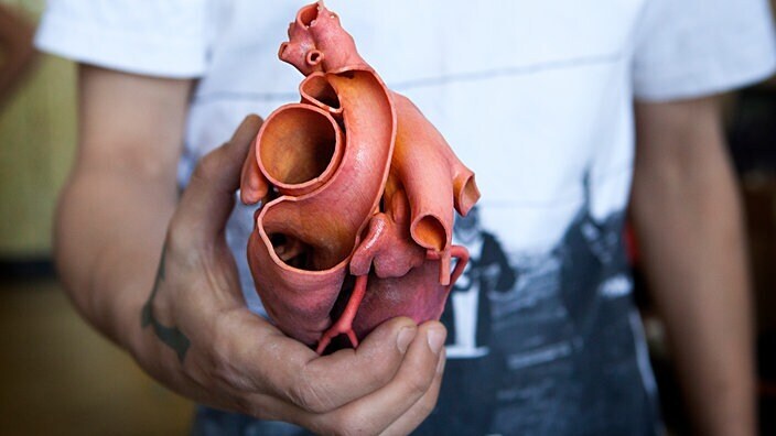 Зубной имплантат, протез стопы, кусок черепной коробки – в медицинской технике 3D-печать пользуется большим успехом.