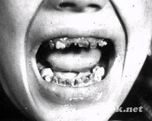 Как я добился судебного преследования НАЗа – и почему именно этот путь оказался действенным