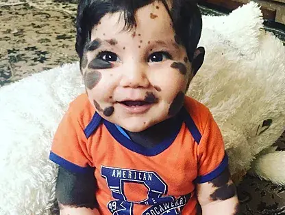 Как живет «Мальчик-панда», которому скоро исполнится 3 года? А врачи прогнозировали ему всего 10 дней