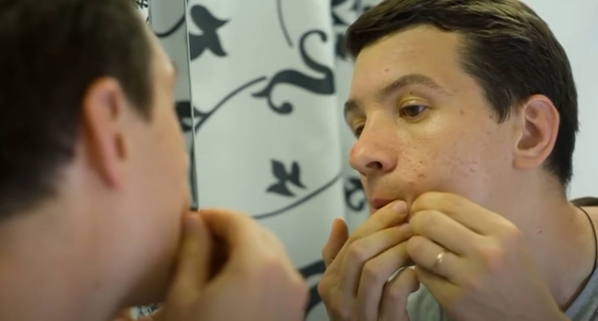 Почему очень опасно выдавливать прыщи?