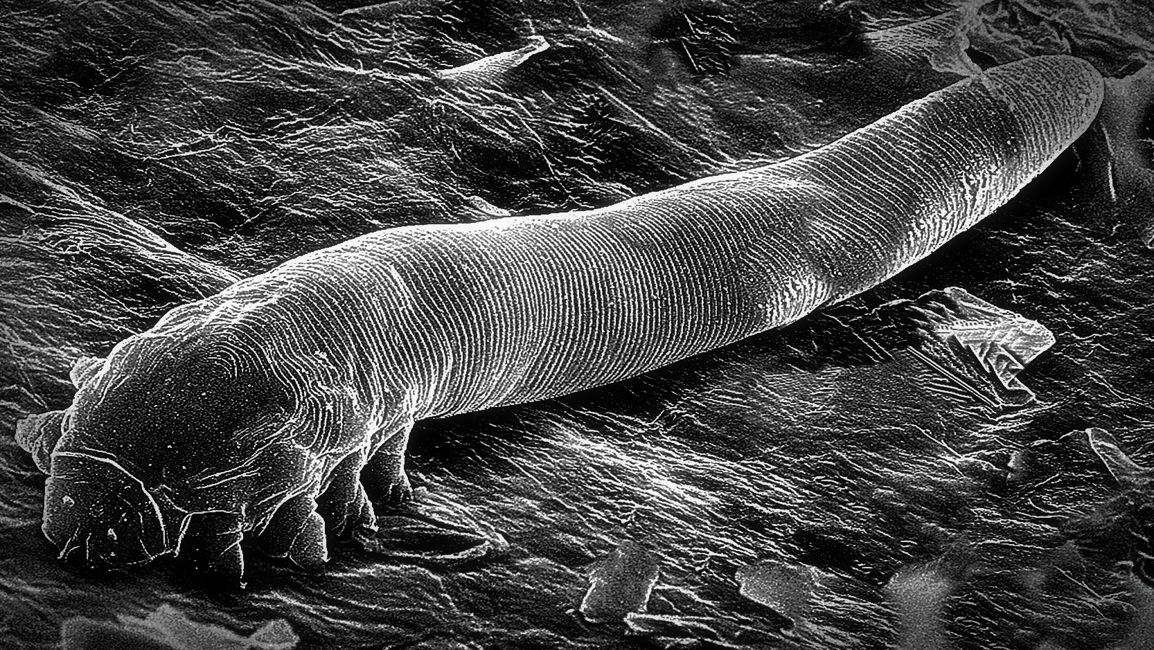 Паразиты на нашем лице.