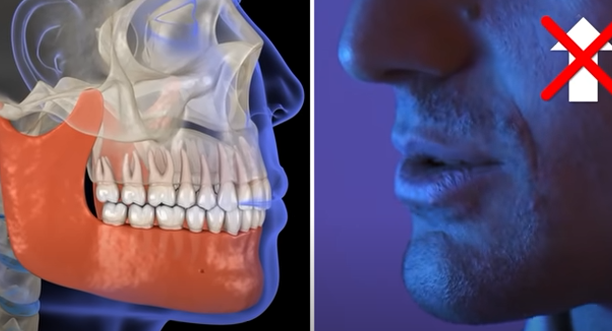 Только у людей есть подбородки