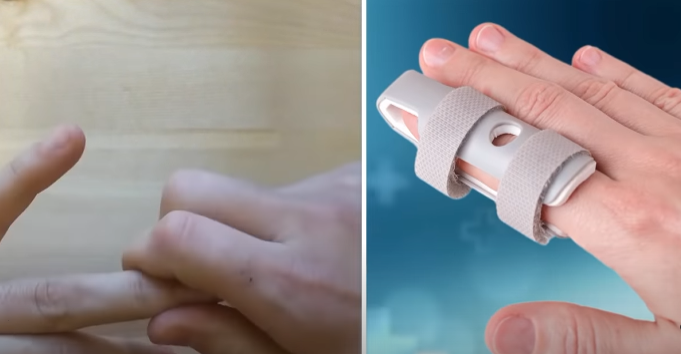 Что будет, если хрустеть пальцами?