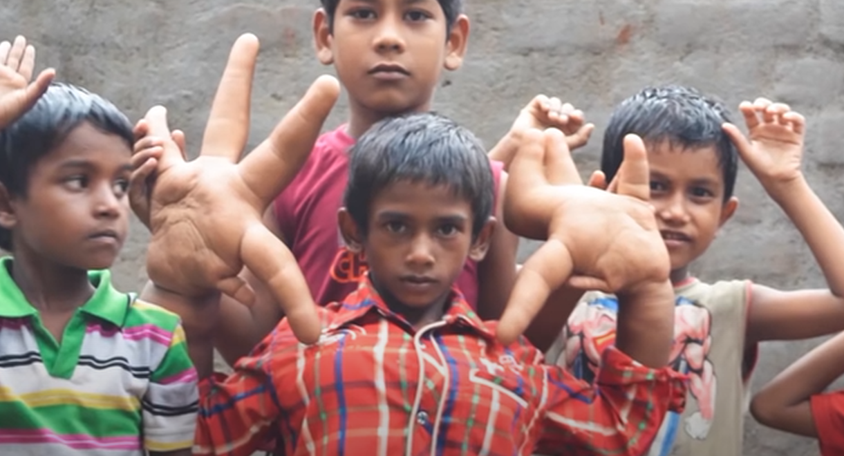 Мальчик с самыми большими руками