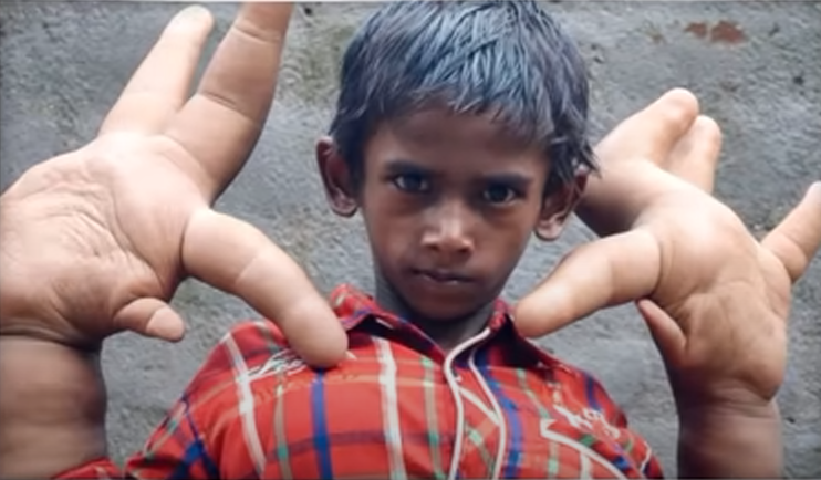 Мальчик с самыми большими руками