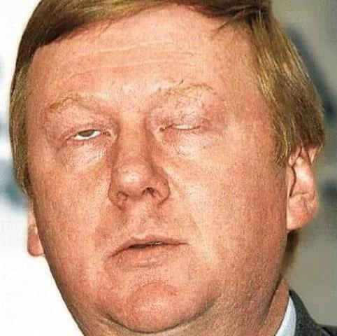 Чубайс - покушение или всё-таки здоровье подкачало ?