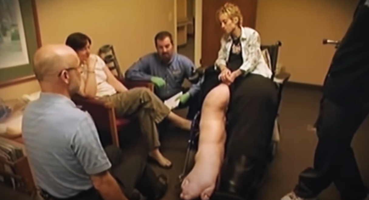 Женщина с огромными ногами