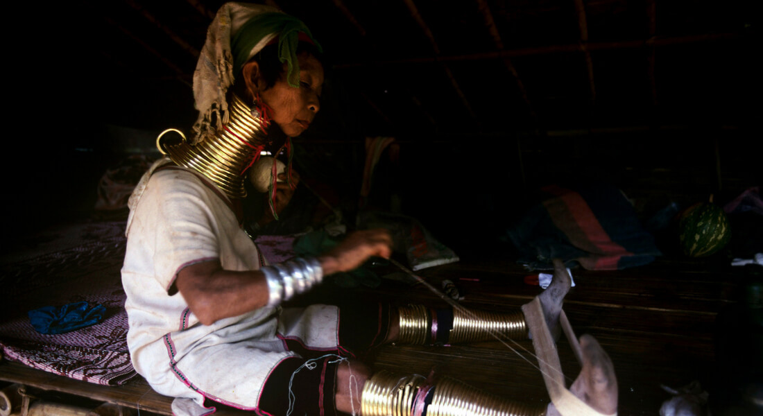 Женщина-Жираф Наконец-То Сняла Кольца С Шеи Спустя Пять Лет