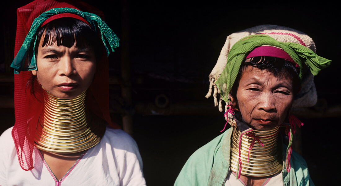 Женщина-Жираф Наконец-То Сняла Кольца С Шеи Спустя Пять Лет