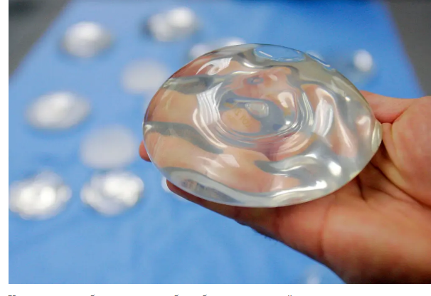 Грудные имплантаты могут быть связаны с дополнительными видами рака, предупреждает FDA