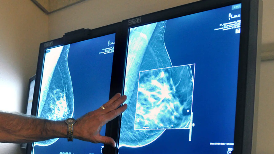 Почему важно знать, плотная ли у вас грудь