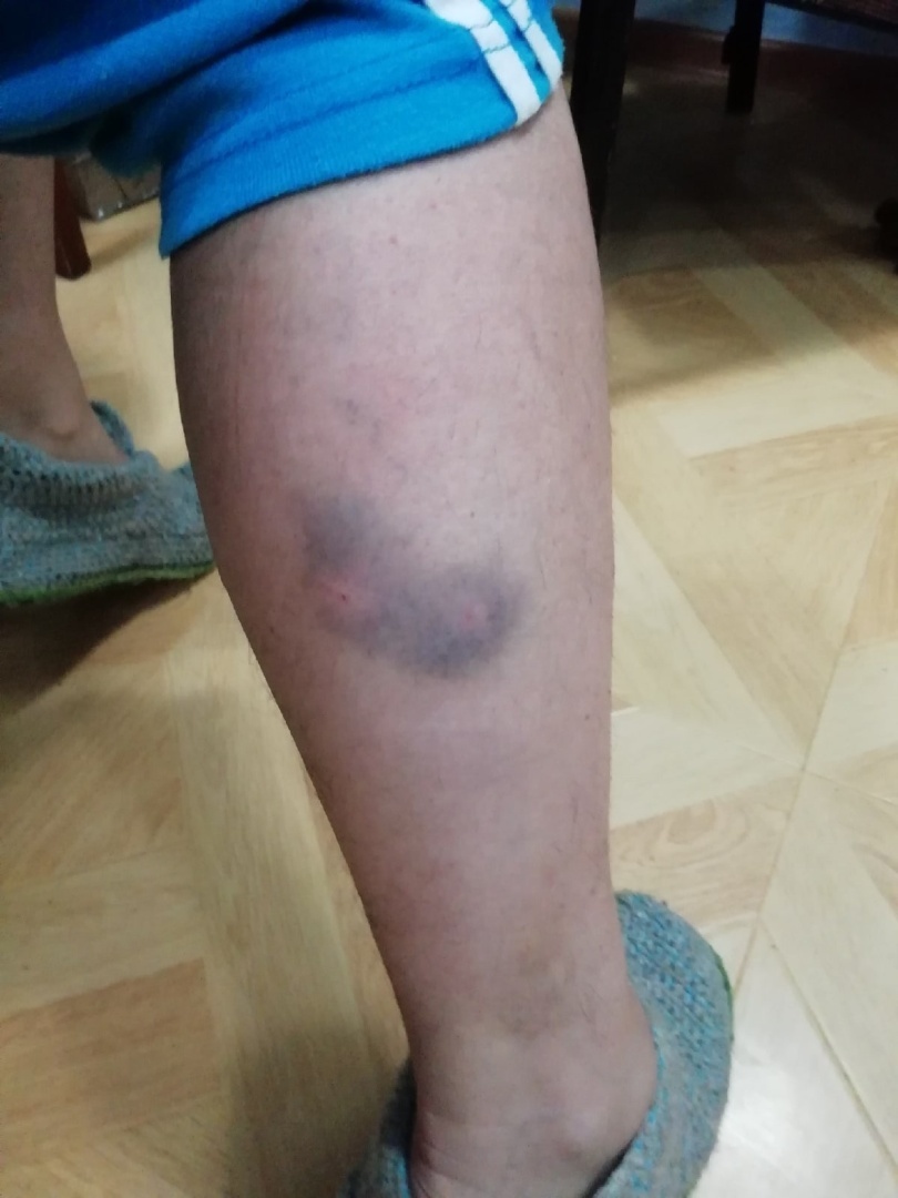 Две дворовые собаки напали на прохожего.