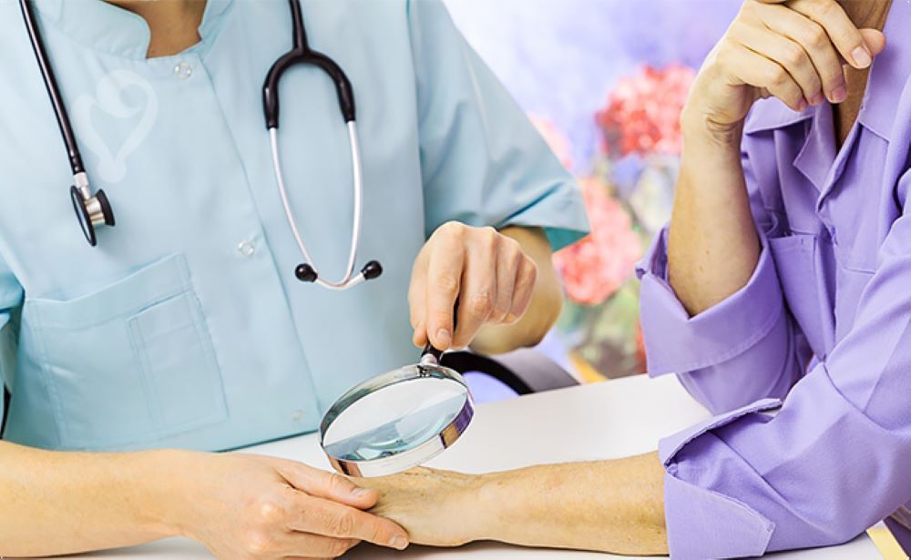 Как избавиться от бородавок на пальцах с помощью эффективных средств?