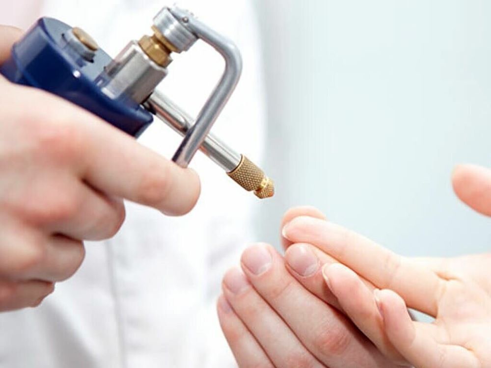 Как избавиться от бородавок на пальцах с помощью эффективных средств?