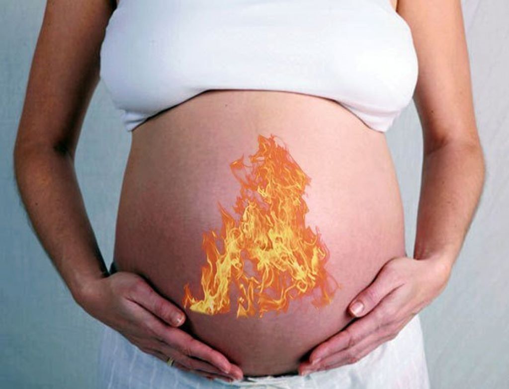 Правда ли когда у беременных изжога значит растут волосы у ребенка