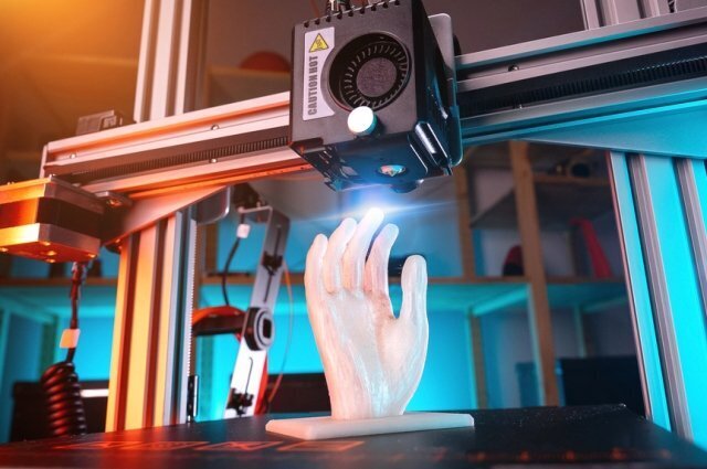 ''Вот уж действительно фантастика''- Нашим раненым ребятам в госпитале Н. Н Бурденко восстанавливают новые части тела (руки, ноги)