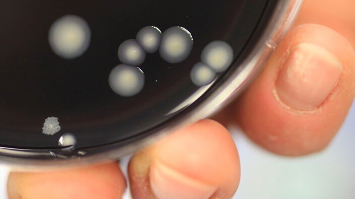 Микроорганизмы: Устойчивые микробы