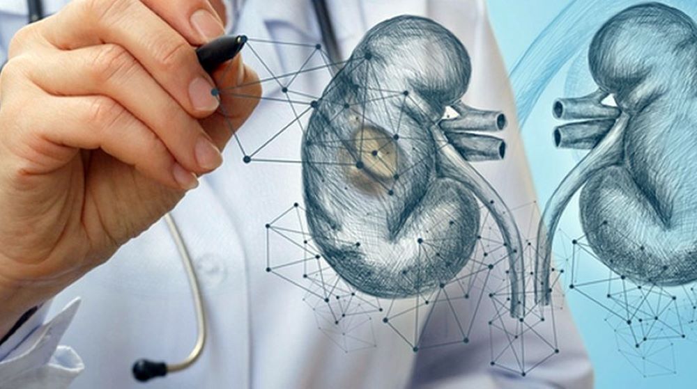 Рак почки – симптомы и диагностика злокачественной опухоли