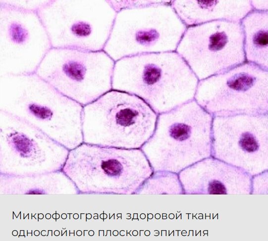 Разработка Пермского политеха поможет выращивать кожу.
