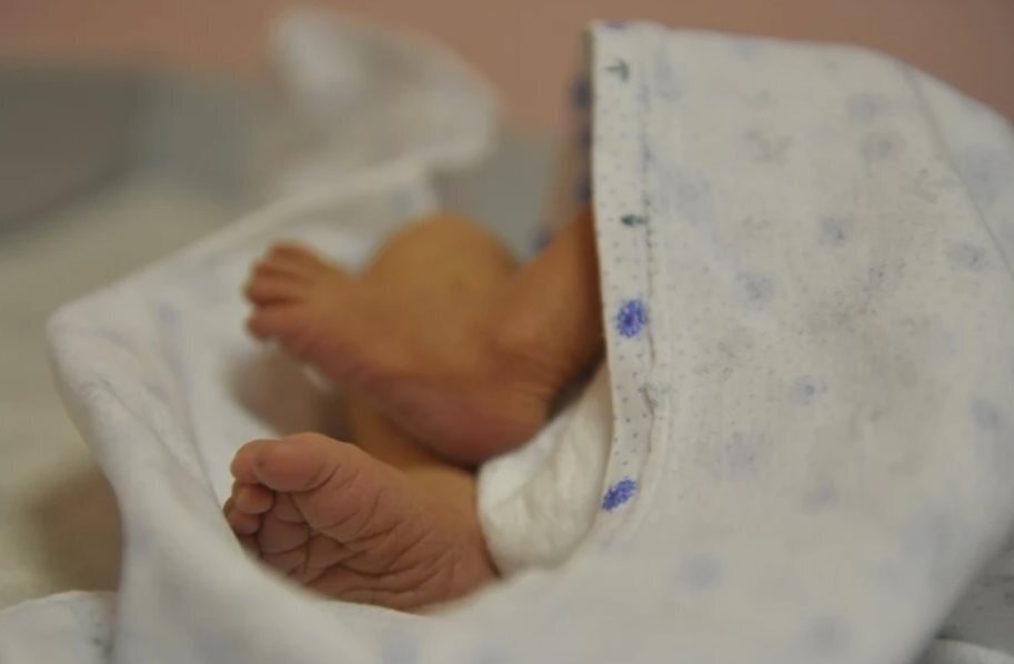 В Мексике родилась девочка с хвостом 6 см