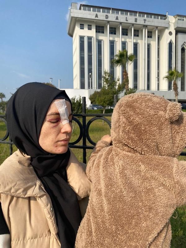 Полиция отпустила мужчину избившего жену