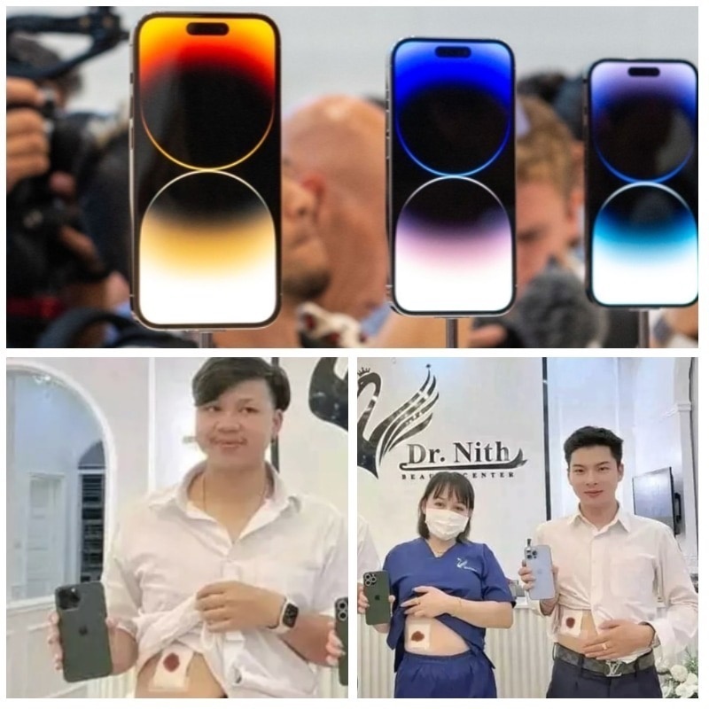 Айфон ценой в свою почку