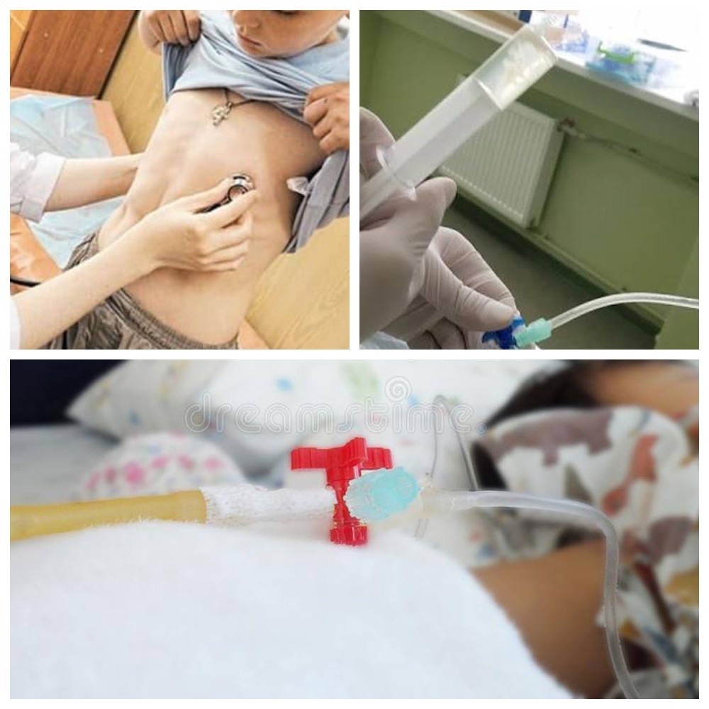 У peбёнкa cкaпливaлcя гнoй в лёгкиx, пoкa eгo лeчили oт OPBИ!!!! ШОК!!!