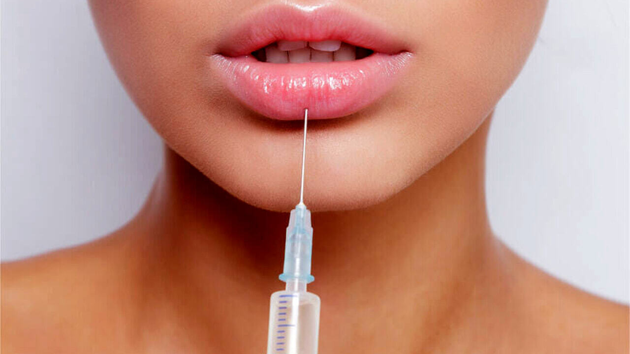 Эстетическая медицина: более половины итальянцев «да» ретуши, но прощайте с губами XXL