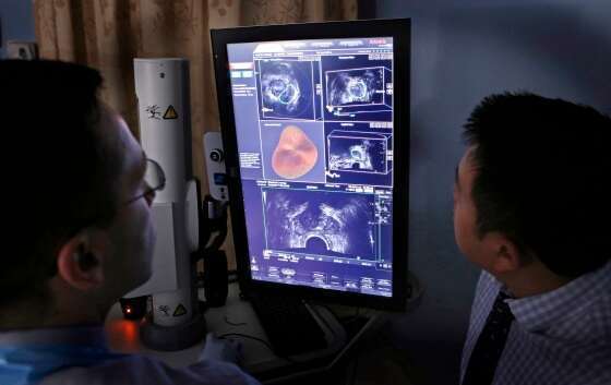 У большего числа мужчин диагностирован рак предстательной железы на поздних стадиях, поскольку скрининг ПСА снижается