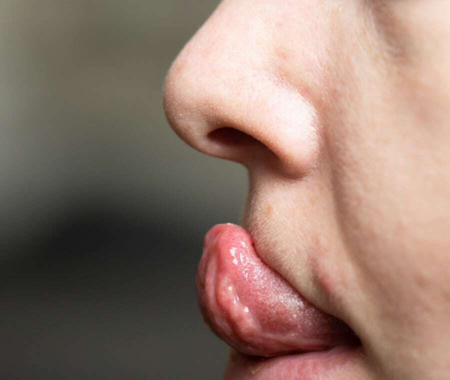 Упражнения, чтобы перестать храпеть