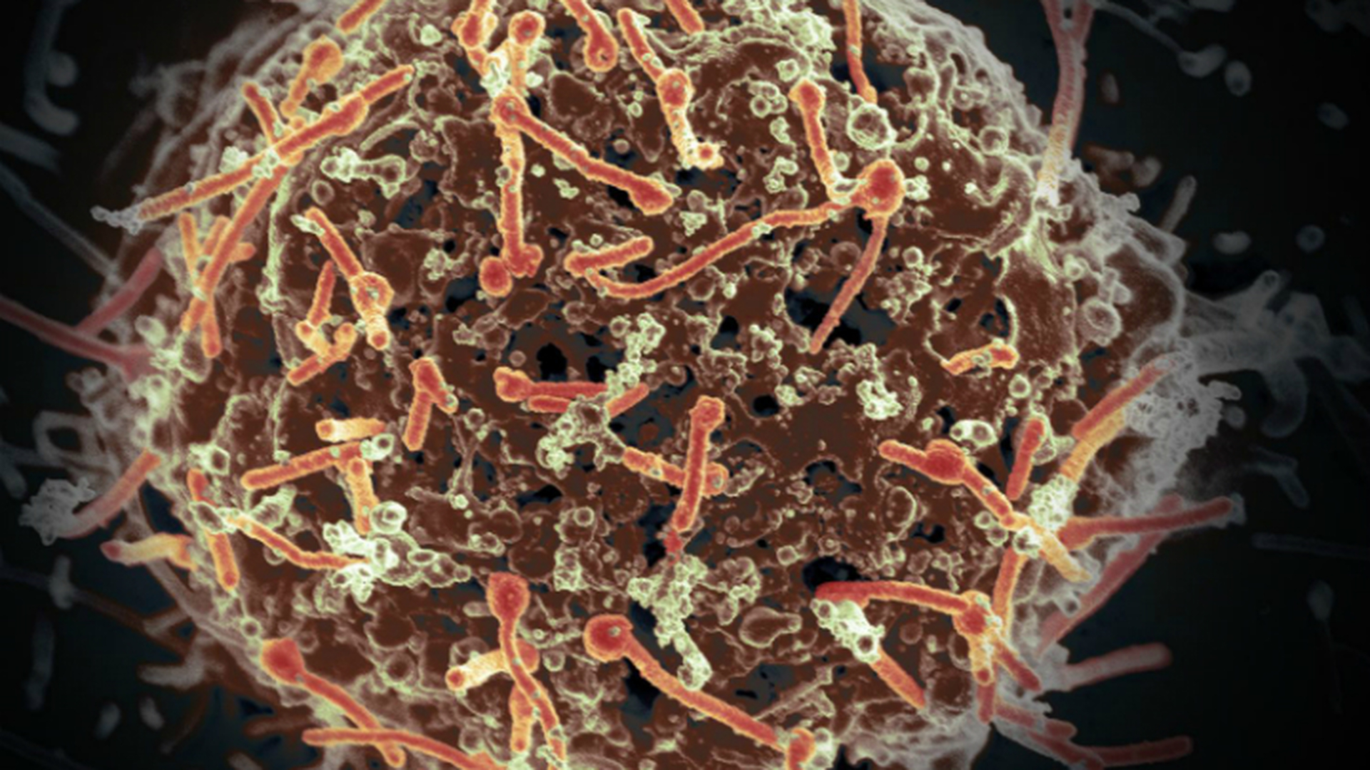 Рак снижается, гвинейский червь уничтожен, лихорадка Эбола уходит - 3 огромные победы для человечества!