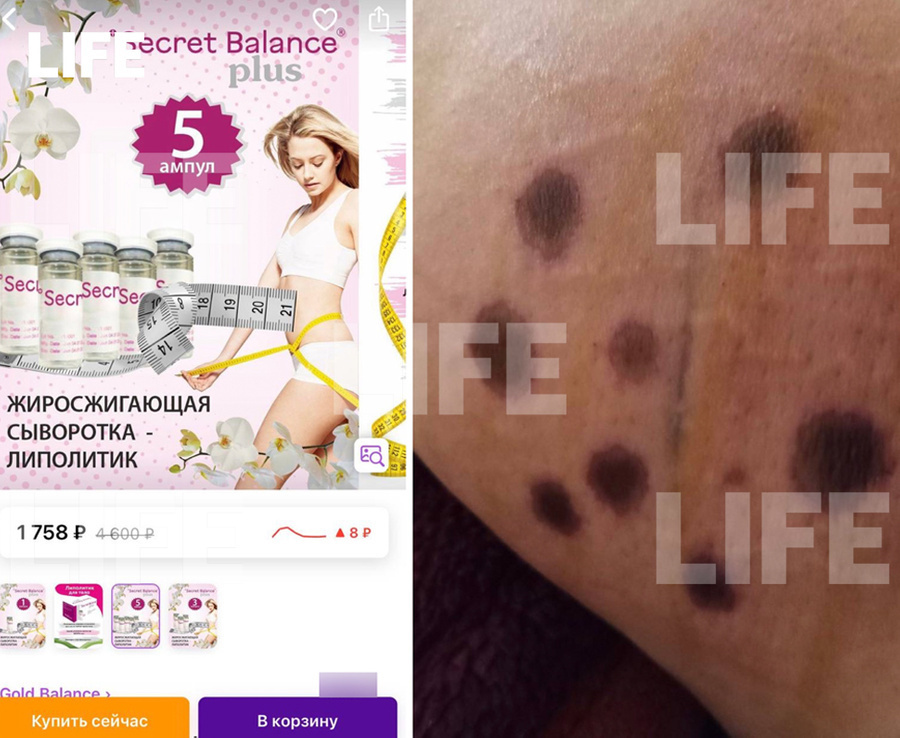 Россиянка рискует жизнью и массовыми убийствами, используя контрафактный липолитик покупая его с Wildberries
