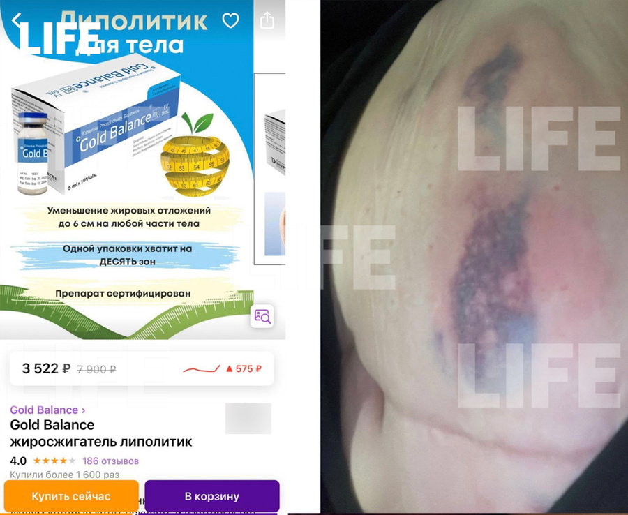 Россиянка рискует жизнью и массовыми убийствами, используя контрафактный липолитик покупая его с Wildberries